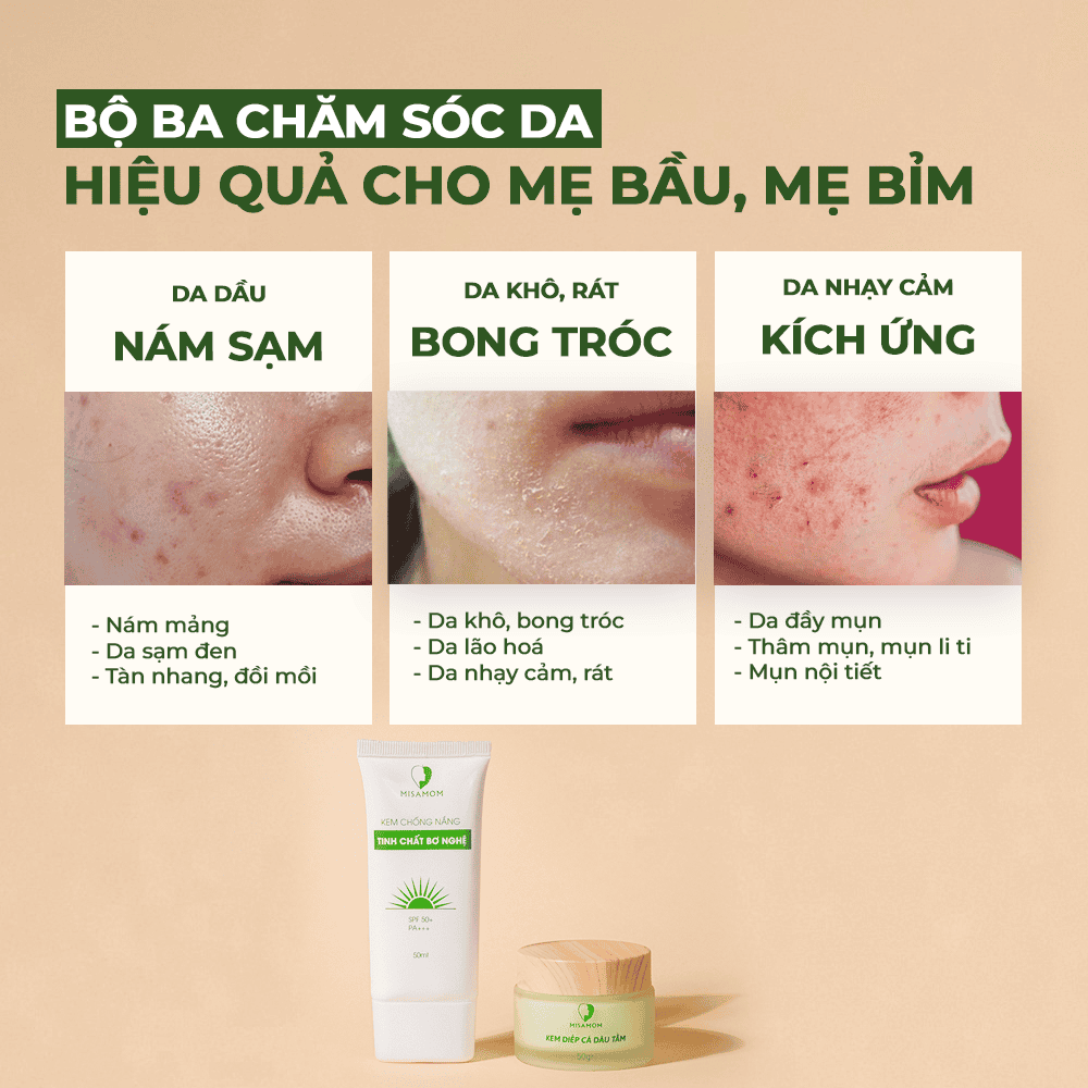 Giới thiệu bộ đôi dưỡng da hoàn hảo của thương hiệu Misamom