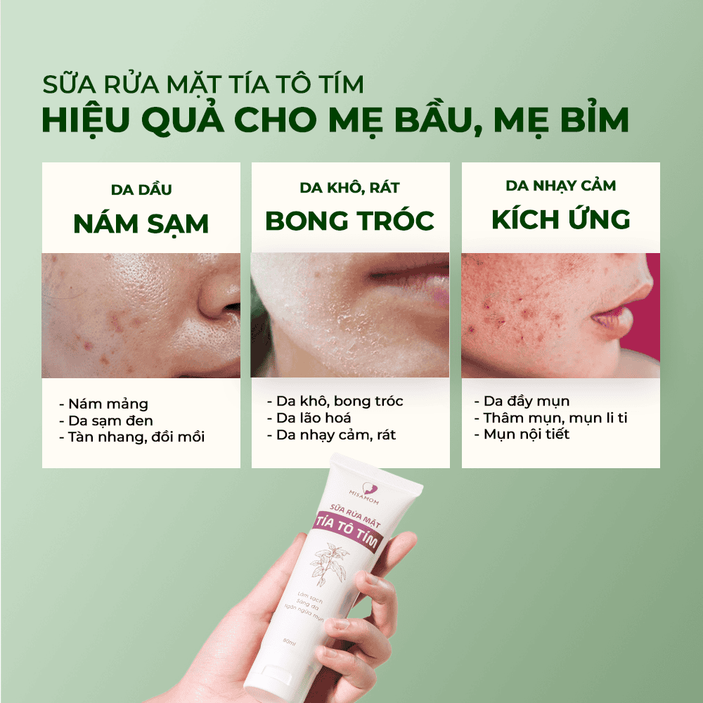 Lý do Sữa Rửa Mặt Tía Tô Tím Misamom được nhiều chị em tin dùng