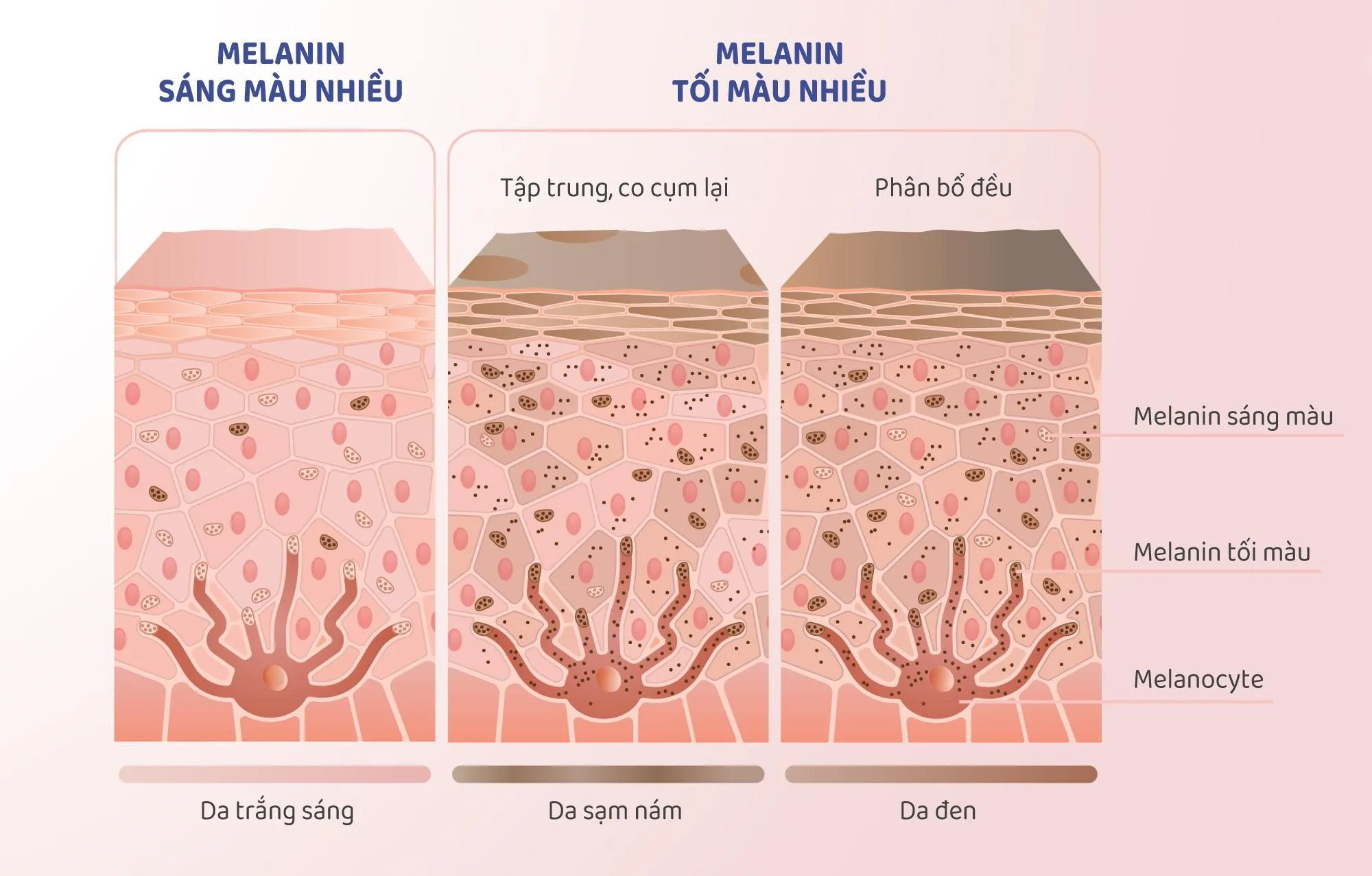 4 Nguyên Nhân chính gây Xạm Nám, Tàn Nhang Trong Thai Kỳ Và Giải Pháp từ Thiên Nhiên
